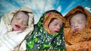 লালপুরে একসঙ্গে তিন সন্তানের জন্ম, ভবিষ্যৎ লালন-পালন নিয়ে পরিবারের দুশ্চিন্তা  #সংবাদ শৈলী